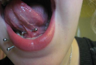 Double Lower Lip And Webbing Piercing