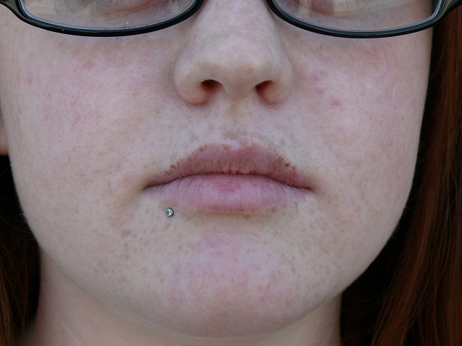 Girl With Side Labret Piercing