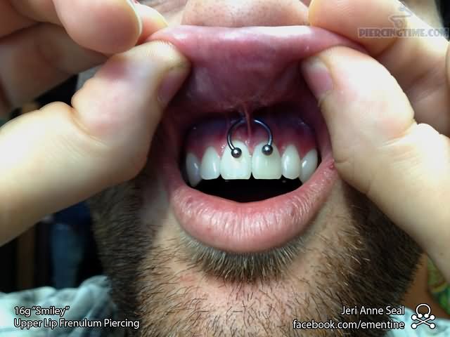 Guy Showing His Smiley Piercing With Silver Circular Ring