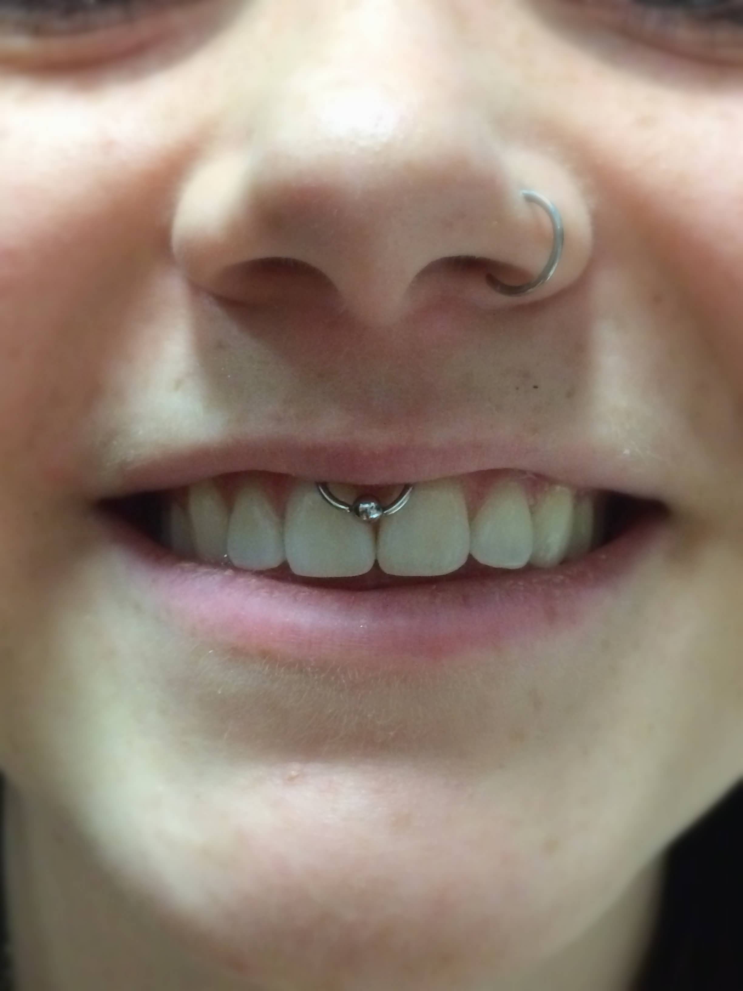 Left Nostril And Smiley Piercing With Hoop Ring