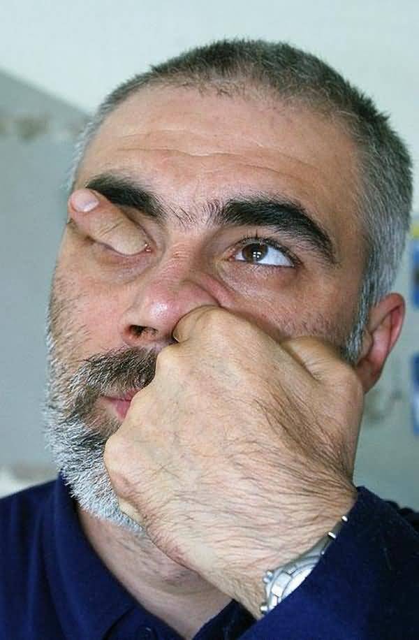 Finger In Nose Out Of Eyes Funny Image