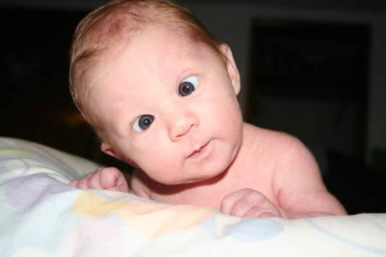 Funny Baby Looking At Camera With Twisting Eyes Picture