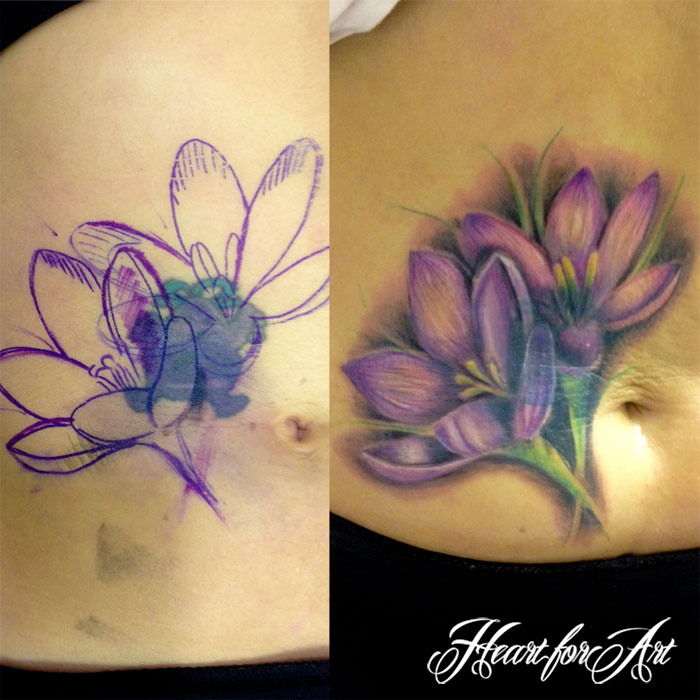 Purple Ink Lily Flower Cover Up Tattoo On Stomach