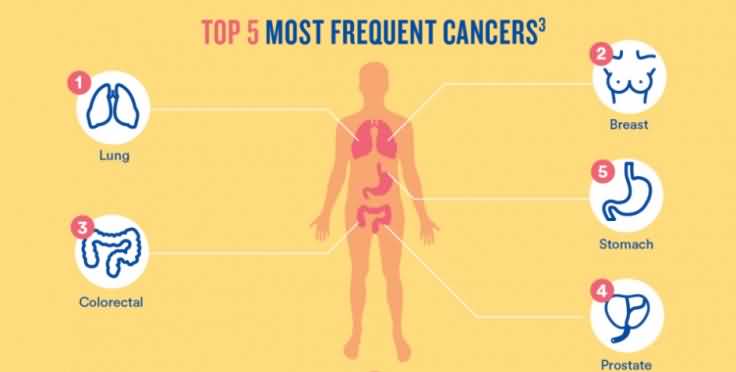 Top 5 most frequent cancers World Cancer Day