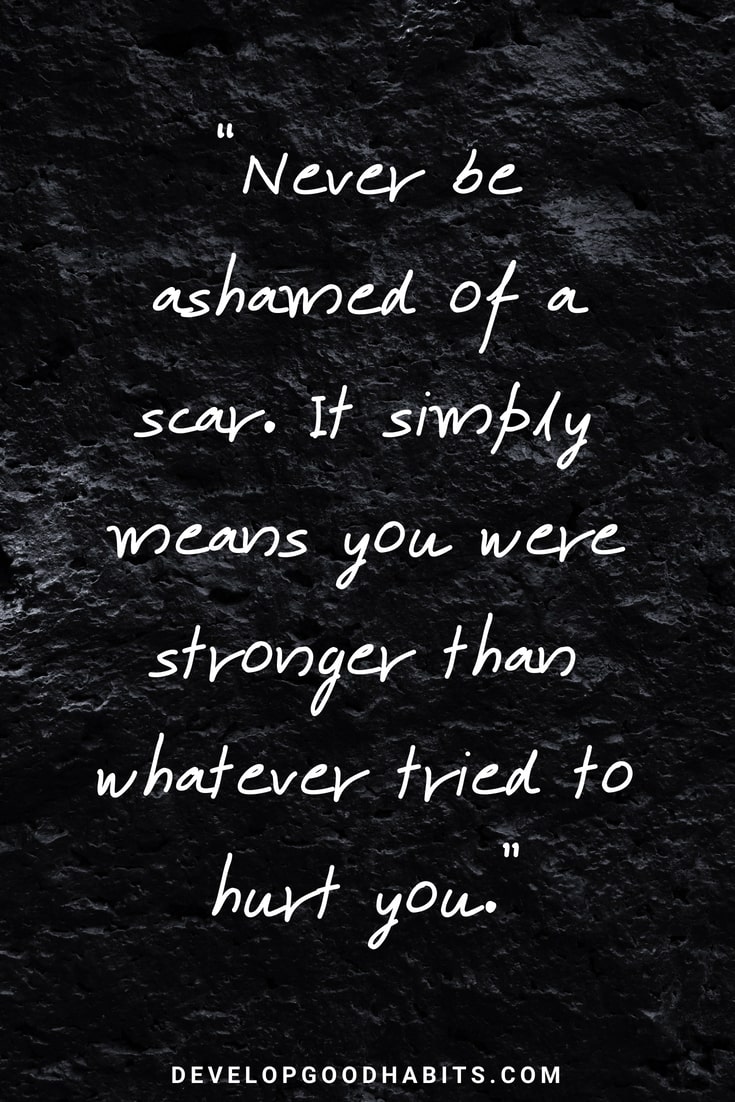 never be ashamed of a scar. it simply means you were stronger than whatever tried to hurt you